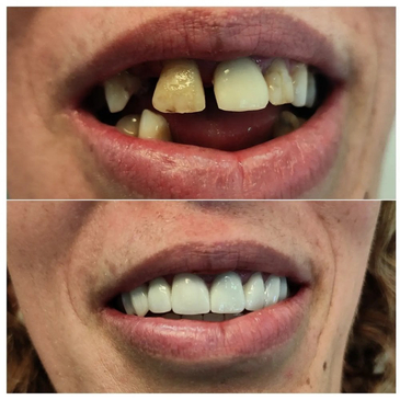 Slider image (3) Klinika Dentale ParaDent